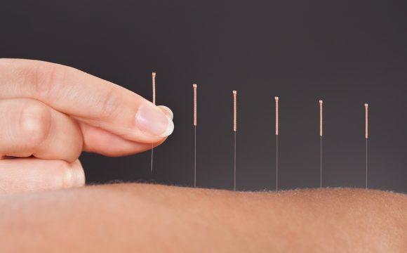 Acupuncture Massage